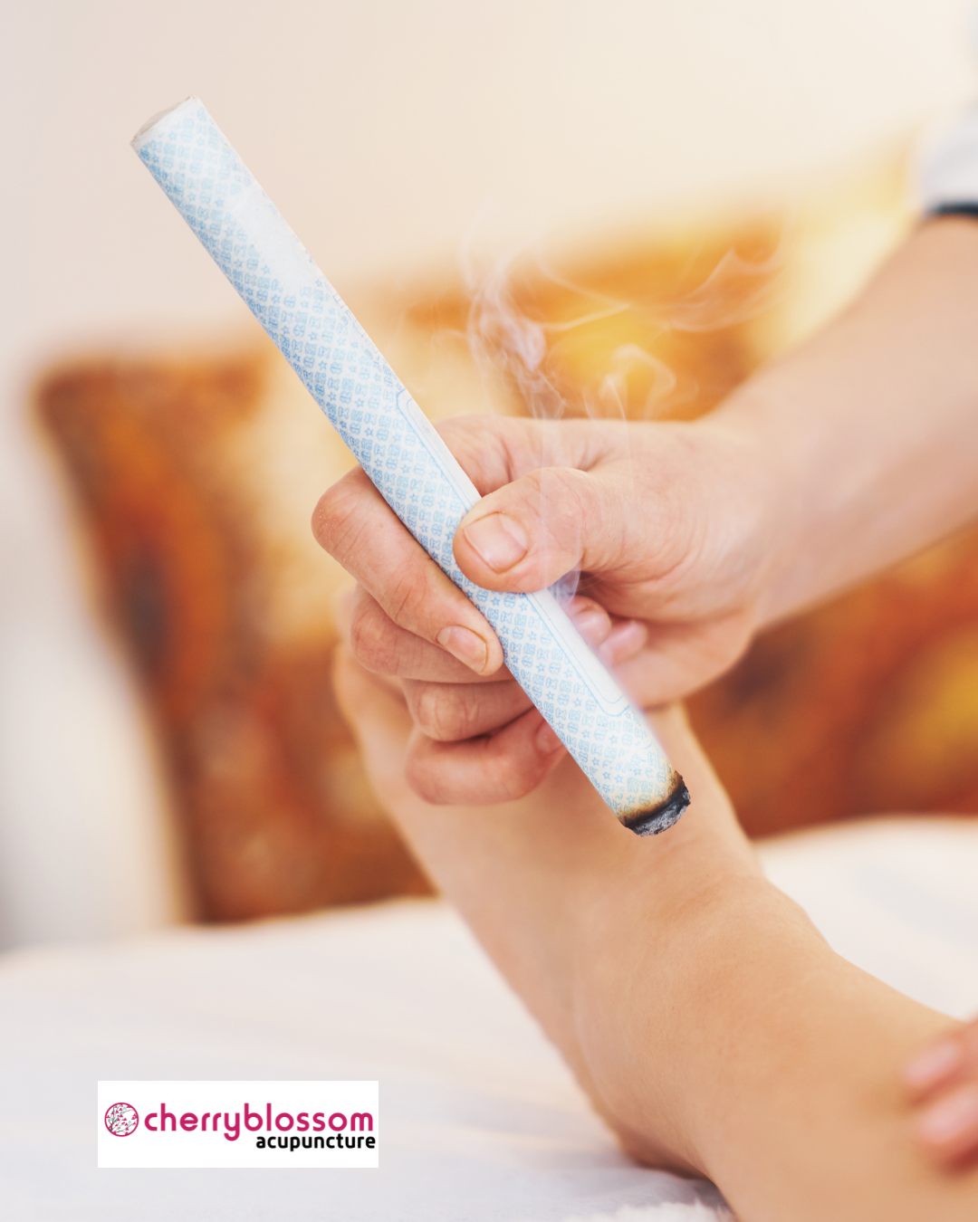 Moxibustion for Breech Babies